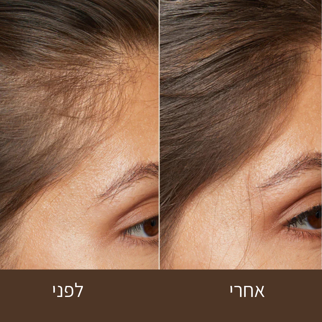 סרום שורשים של טמאשי