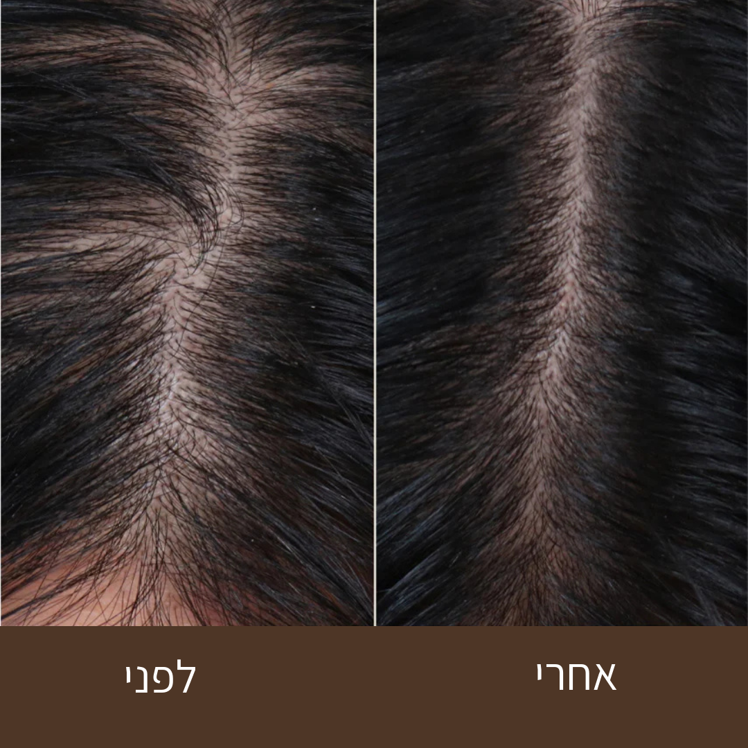סרום שורשים של טמאשי